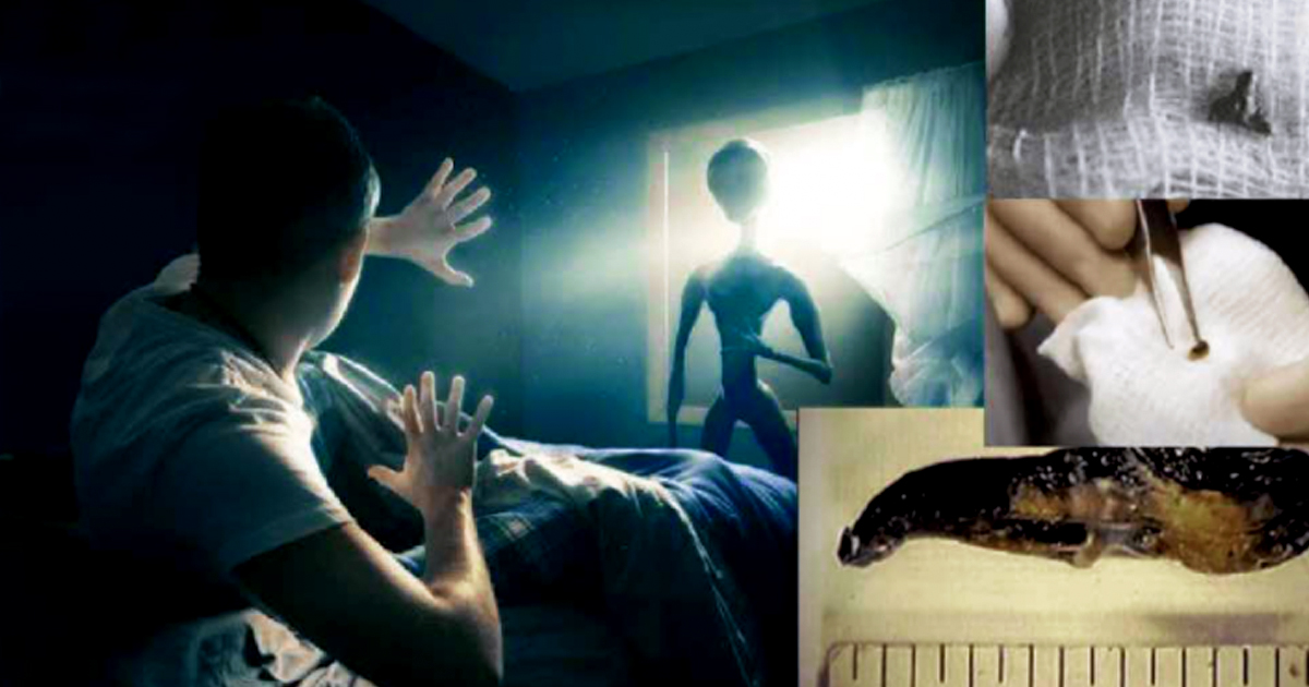 El famoso cirujano Roger Leir realizó un estudio que muestra misteriosos implantes alienígenas: ovnis y misterios 1 1646335892 El famoso cirujano Roger Leir realizo un estudio que muestra