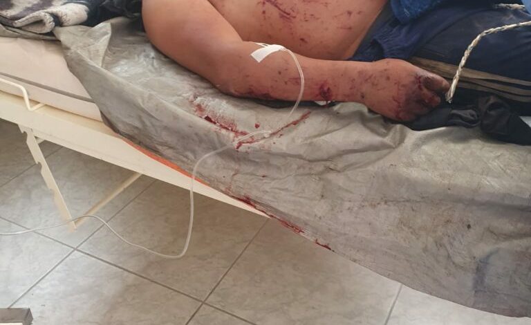 Presunto ataque a faenas mineras deja tres muertos y un herido grave - EPA Noticias 1 Presunto ataque a faenas mineras deja tres muertos y un