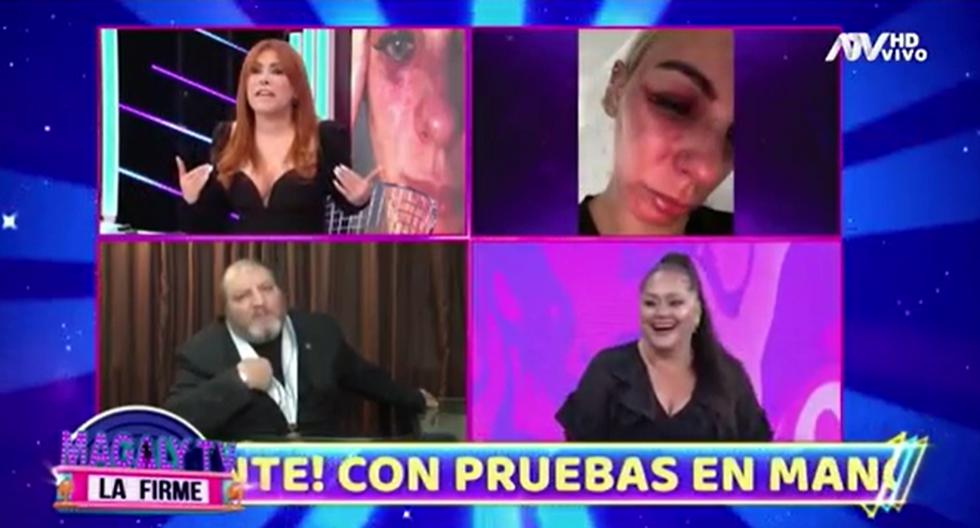 Magaly Medina y el tenso enfrentamiento con el abogado de John Kelvin: "No me grites" (VIDEO) 1 1666669541 Magaly Medina y el tenso enfrentamiento con el abogado de