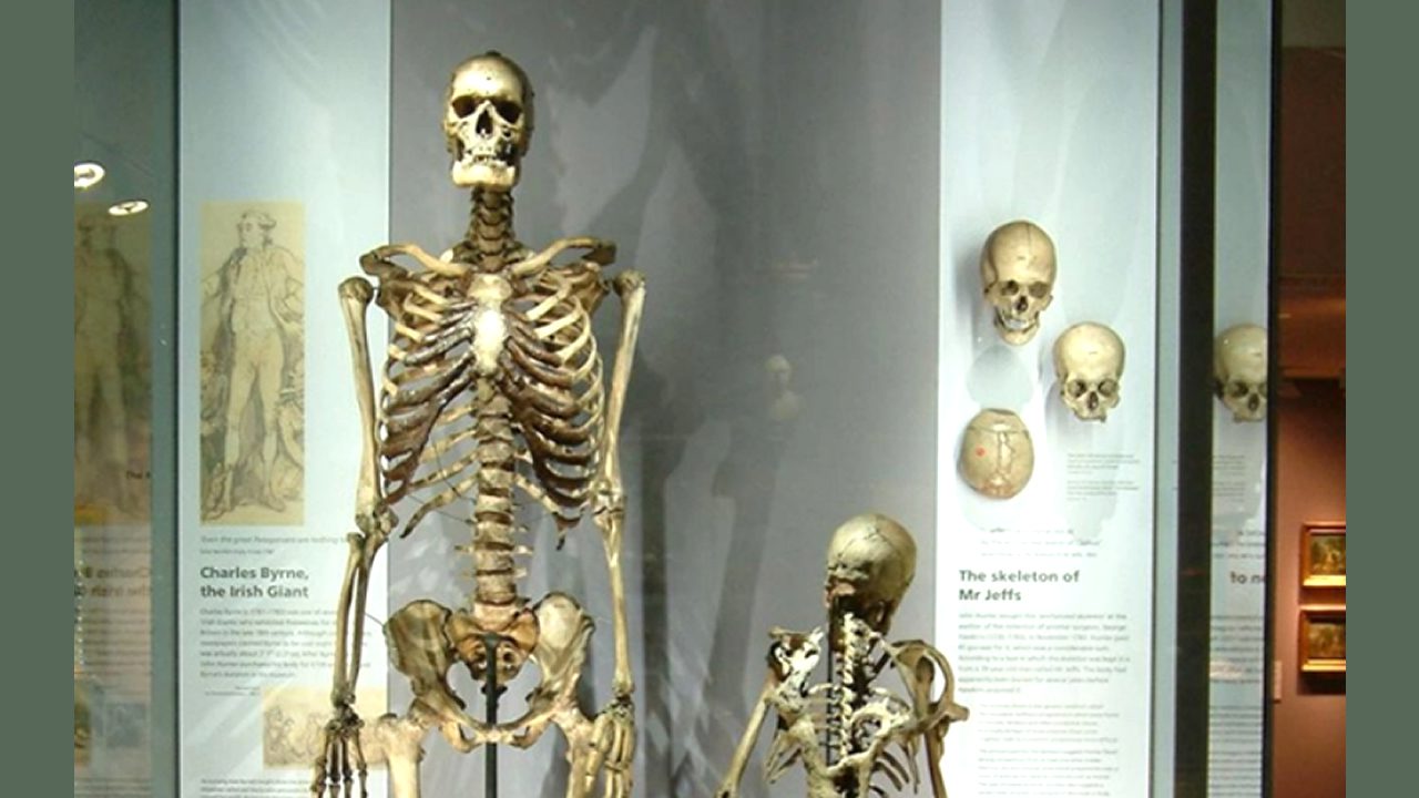 Esqueleto del “gigante irlandés” será retirado de museo luego de 200 años 1 gigante irlandes portada