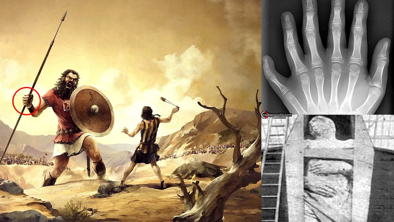 Humanos de seis dedos: ¿Indicadores de una civilización perdida? 1 humanos seis dedos indicadores civilizacion perdida portada